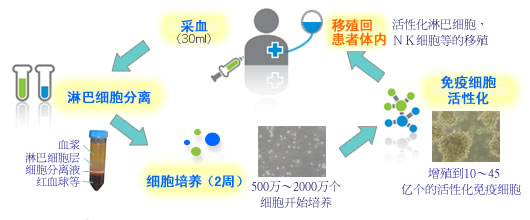 活化自身淋巴细胞・自然杀伤细胞的免疫治疗